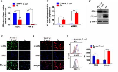 Fusobacterium nucleatum Facilitates M2 Macrophage Polarization and Colorectal Carcinoma Progression by Activating TLR4/NF-κB/S100A9 Cascade